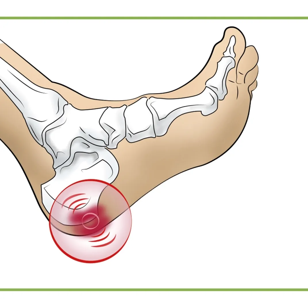 Aide Et Accessoires Confort|Soins Des Pieds Et Accessoires|Tempsl Talonnettes pour épine calcanéenne Modèle femme